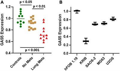 Downregulated lncRNA GAS5 and Upregulated miR-21 Lead to Epithelial–Mesenchymal Transition and Lung Metastasis of Osteosarcomas